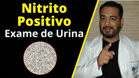 nitrito positivo na urina - caimbra na panturrilha